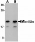 NDUFAF2 / NDUFA12L Antibody (C-Terminus)